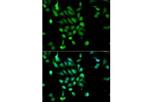 Immunofluorescence (IF) image for anti-Proteasome (Prosome, Macropain) 26S Subunit, ATPase, 5 (PSMC5) (AA 127-406) antibody (ABIN3022098)
