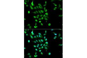 Immunofluorescence analysis of MCF7 cell using PSMC5 antibody. (PSMC5 Antikörper  (AA 127-406))