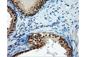 Immunohistochemical staining of paraffin-embedded Kidney tissue using anti-TPMT mouse monoclonal antibody. (TPMT Antikörper)