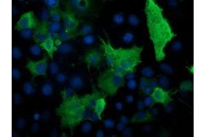 Immunofluorescence (IF) image for anti-Protein Kinase, CAMP-Dependent, Regulatory, Type I, beta (PRKAR1B) antibody (ABIN1500409) (PRKAR1B Antikörper)