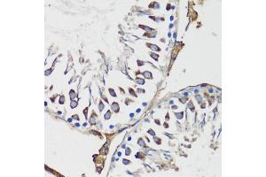 Immunohistochemistry of paraffin-embedded rat testis using Cyclin B1 antibody (ABIN7266555) at dilution of 1:100 (40x lens). (Cyclin B1 Antikörper  (C-Term))