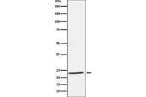 Western blot analysis of IL32 expression in Human tonsil lysate.