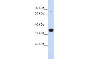 WB Suggested Anti-RHOT1 Antibody Titration:  0.