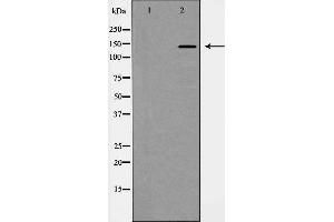 Western blot analysis of PDGFR α expression in HepG2 cells. (PDGFRA Antikörper  (C-Term))