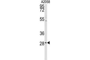 Western Blotting (WB) image for anti-Protein Kinase C, delta Binding Protein (PRKCDBP) antibody (ABIN3003490) (PRKCDBP Antikörper)