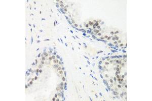 Immunohistochemistry of paraffin-embedded human prostate using PPAN antibody at dilution of 1:200 (40x lens). (PPAN Antikörper)