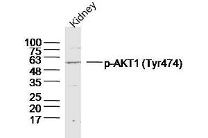 Mouse kidney lysates probed with AKT1/2/3 (Tyr474) Polyclonal Antibody, unconjugated  at 1:300 overnight at 4°C followed by a conjugated secondary antibody at 1:10000 for 90 minutes at 37°C. (AKT 1/2/3 Antikörper  (pTyr474))