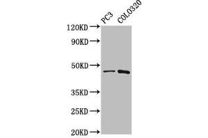 Western Blot Positive WB detected in: PC-3 whole cell lysate, Colo320 whole cell lysate All lanes: CAPS2 antibody at 5. (Calcyphosine 2 Antikörper  (AA 191-274))