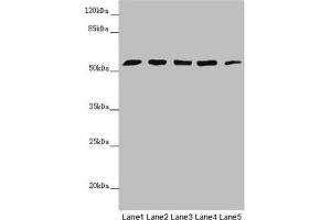 Western blot All lanes: CEP57L1 antibody at 6. (CEP57L1 Antikörper  (AA 1-167))