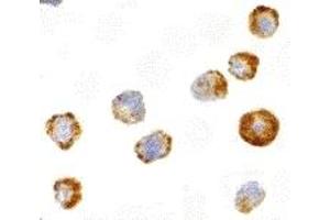 Immunohistochemistry (IHC) image for anti-Mitogen-Activated Protein Kinase Kinase Kinase 5 (MAP3K5) antibody (ABIN1030199) (ASK1 Antikörper)