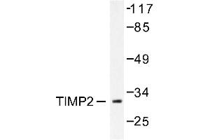 Image no. 1 for anti-Metalloproteinase Inhibitor 2 (TIMP2) antibody (ABIN271854) (TIMP2 Antikörper)