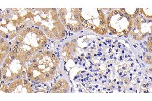 Immunohistochemistry (IHC) image for anti-BCL2-Like 1 (BCL2L1) (AA 2-212) antibody (ABIN7437176)
