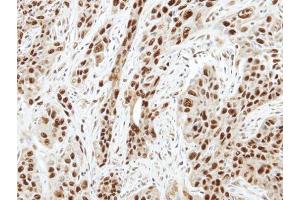 Immunohistochemistry (IHC) image for anti-Aurora Kinase A (AURKA) (C-Term) antibody (ABIN2855868)