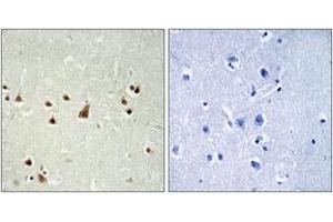 Immunohistochemistry analysis of paraffin-embedded human brain, using ANKRD26 Antibody. (ANKRD26 Antikörper  (AA 791-840))