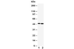 Western blot testing of 5HT1A Receptor antibody and Lane 1:  rat brain (Serotonin Receptor 1A Antikörper  (C-Term))