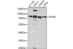 Western blot analysis of extracts of various cell lines using PARN Polyclonal Antibody at dilution of 1:1000. (PARN Antikörper)
