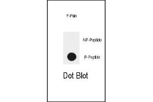 Dot blot analysis of anti-EGFR-p Phospho-specific Pab (ABIN389792 and ABIN2839693) on nitrocellulose membrane.