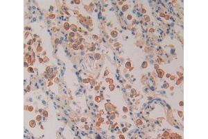 Used in DAB staining on fromalin fixed paraffin- embedded Kidney tissue (Proteasome 26S Subunit, Non ATPase 5 (AA 143-341) Antikörper)