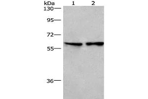 Western Blot analysis of Lovo cell and Mouse lung tissue using CD244 Polyclonal Antibody at dilution of 1:526