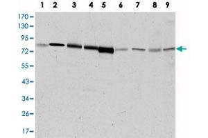 Western blot analysis using ADRBK1 monoclonal antibody, clone 3F8  against HeLa (1), Jurkat (2), MOLT 4 (3), Raji (4), THP-1 (5), L1210 (6), COS-7 (7), PC-12 (8), and NIH/3T3 (9) cell lysate. (GRK2 Antikörper)