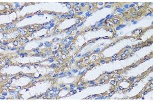 Immunohistochemistry of paraffin-embedded Mouse kidney using NQO2 Polyclonal Antibody at dilution of 1:100 (40x lens). (NQO2 Antikörper)