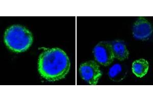 Confocal immunofluorescence analysis of methanol-fixed HEK293 cells trasfected with AXL-hIgGFc using AXL antibody (green), showing cytoplasmic and membrane localization. (AXL Antikörper)