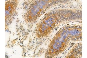 ABIN6261947 and ABIN6276873 at 1/100 staining human normal colon tissue by IHC-P. (GGT1 Antikörper  (N-Term))