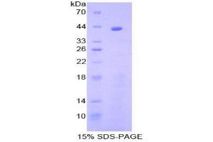 SDS-PAGE analysis of Human C8b Protein. (C8B Protein)
