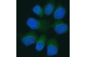 IF analysis of Pannexin 1/PANX1 using anti-Pannexin 1/PANX1 antibody (ABIN7599312).