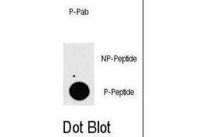 Dot Blot (DB) image for anti-TGF-beta Activated Kinase 1/MAP3K7 Binding Protein 1 (TAB1) (pSer423) antibody (ABIN5021453)