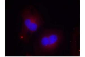 Image no. 2 for anti-PTK2 Protein tyrosine Kinase 2 (PTK2) (pTyr925) antibody (ABIN196825) (FAK Antikörper  (pTyr925))