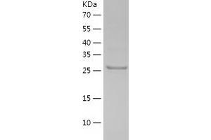 Western Blotting (WB) image for Pyridoxal (Pyridoxine, Vitamin B6) Phosphatase (PDXP) (AA 1-292) protein (His tag) (ABIN7124712) (PDXP Protein (AA 1-292) (His tag))