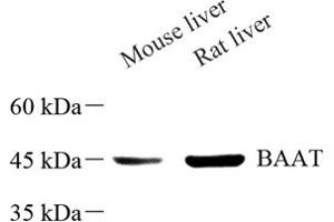 Western blot analysis of BAAT (ABIN7073212) at dilution of 1: 500