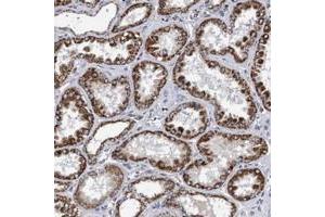 Immunohistochemical staining of human kidney with COBL polyclonal antibody  shows strong granular cytoplasmic positivity in tubular cells at 1:200-1:500 dilution. (COBL Antikörper)