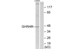 Western blot analysis of extracts from LOVO cells, using GHRHR antibody. (GHRHR Antikörper  (C-Term))