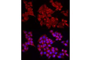 Immunofluorescence (IF) image for anti-ADAM Metallopeptidase with Thrombospondin Type 1 Motif, 1 (ADAMTS1) (AA 718-967) antibody (ABIN7265439)