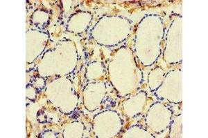 Immunohistochemistry of paraffin-embedded human thyroid tissue using ABIN7161000 at dilution of 1:100 (ME3 Antikörper  (AA 547-598))