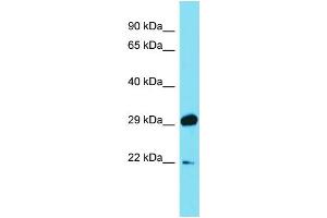 Host: Rabbit Target Name: PGAM1 Sample Type: Fetal Brain lysates Antibody Dilution: 1. (PGAM1 Antikörper  (C-Term))