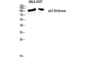 Western Blot (WB) analysis of HeLa 293T lysis using p52 S6 kinase antibody. (RPS6KC1 Antikörper  (Internal Region))