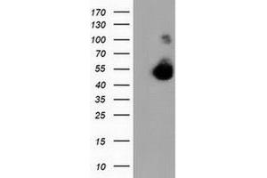 HEK293T cells were transfected with the pCMV6-ENTRY control (Left lane) or pCMV6-ENTRY CALCOCO2 (Right lane) cDNA for 48 hrs and lysed. (CALCOCO2 Antikörper)