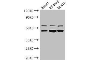 Western Blot Positive WB detected in: Mouse heart tissue, , Mouse kidney tissue, Mouse brain tissue All lanes: HNF4A antibody at 3 μg/mL Secondary Goat polyclonal to rabbit IgG at 1/50000 dilution Predicted band size: 53, 52, 47, 57, 51, 49, 44 kDa Observed band size: 53, 47 kDa (HNF4A Antikörper  (AA 130-330))