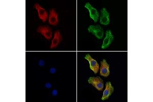 ABIN7094439 and ABIN7098487 staining Hela cells by IF/ICC.