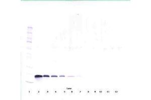 Image no. 2 for anti-Vascular Endothelial Growth Factor A (VEGFA) antibody (ABIN465336) (VEGFA Antikörper)