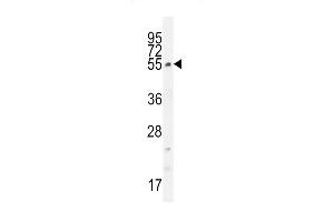 CCDC61 Antikörper  (N-Term)