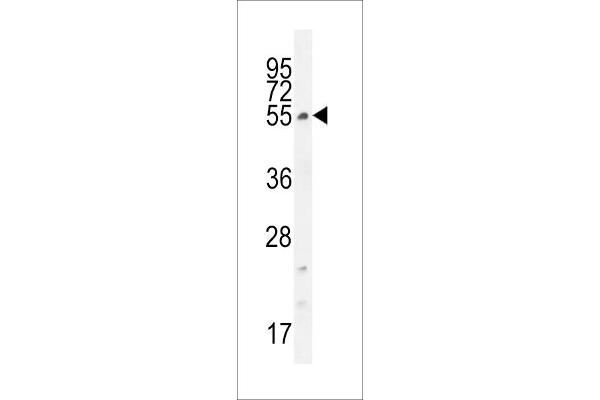 CCDC61 Antikörper  (N-Term)