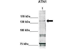 WB Suggested Anti-ATN1 Antibody  Positive Control: Lane1: 30ug human fibroblasts  Primary Antibody Dilution :  1:500 Secondary Antibody :  Anti-rabbit-HRP  Secondry Antibody Dilution :  1:1000 Submitted by: Anonymous (Atrophin 1 Antikörper  (N-Term))
