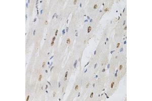Immunohistochemistry of paraffin-embedded rat heart using KPNA4 Antibody (ABIN5971058) at dilution of 1/200 (40x lens). (KPNA4 Antikörper)