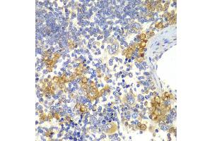 Immunohistochemistry of paraffin-embedded rat spleen using NOTCH1 antibody (ABIN5995370) at dilution of 1/100 (40x lens). (Notch1 Antikörper)