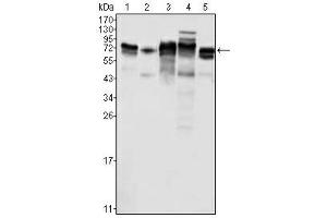 Western Blotting (WB) image for anti-Metadherin (MTDH) antibody (ABIN1108306) (MTDH Antikörper)