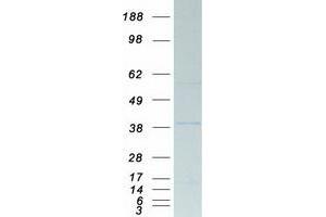Western Blotting (WB) image for Protein Phosphatase 2, Catalytic Subunit, alpha Isozyme (PPP2CA) protein (Myc-DYKDDDDK Tag) (ABIN2729485)